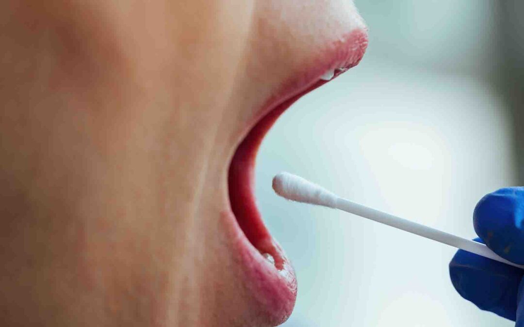 Diagnostic de l’endométriose : le test salivaire en voie de remboursement